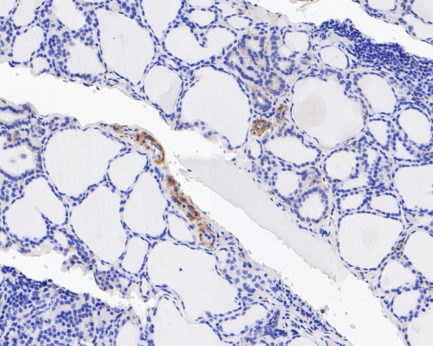 Integrin beta 3 Antibody in Immunohistochemistry (Paraffin) (IHC (P))