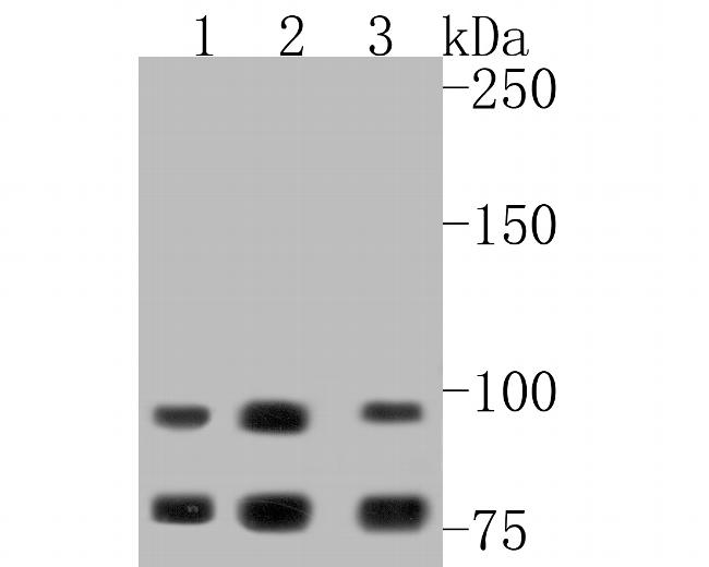 GAA Antibody in Western Blot (WB)