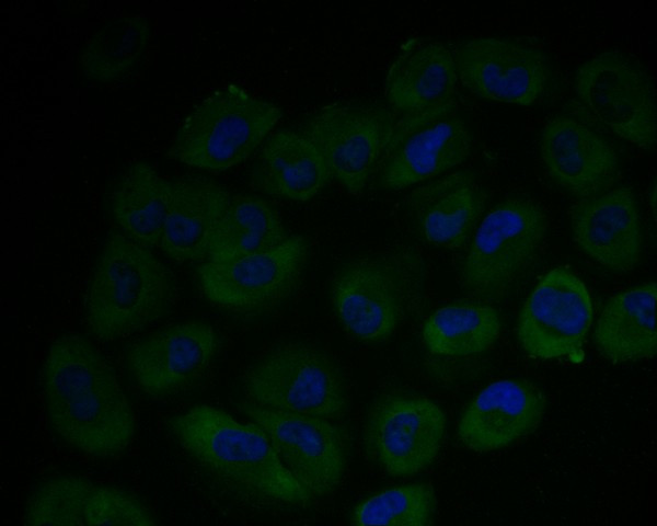 ARG2 Antibody in Immunocytochemistry (ICC/IF)