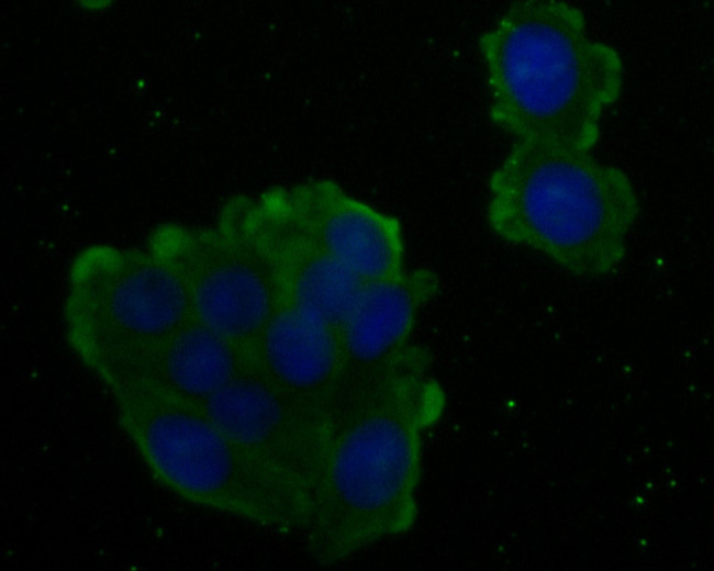 ARG2 Antibody in Immunocytochemistry (ICC/IF)