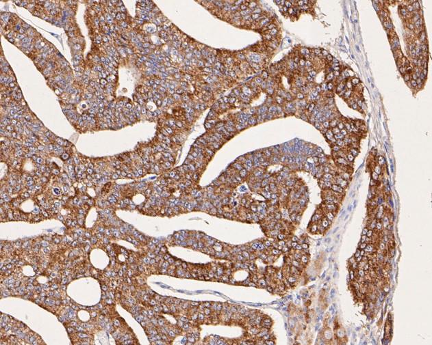 ARG2 Antibody in Immunohistochemistry (Paraffin) (IHC (P))