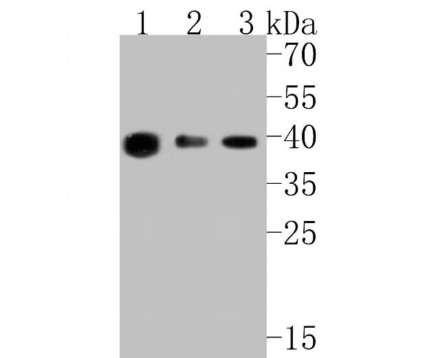 ARG2 Antibody in Western Blot (WB)