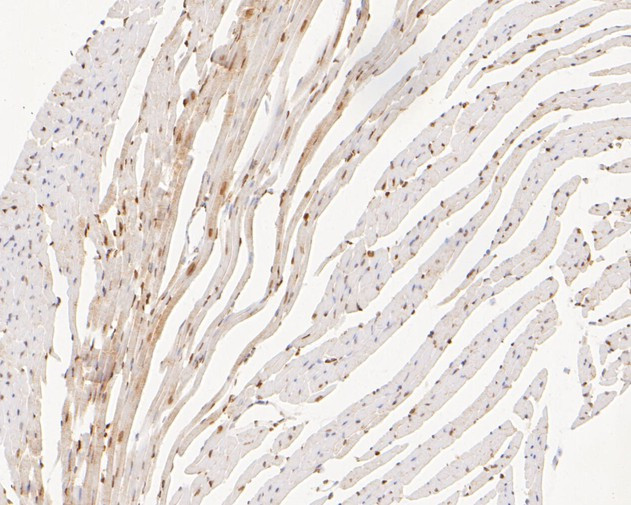 SUPT5H Antibody in Immunohistochemistry (Paraffin) (IHC (P))