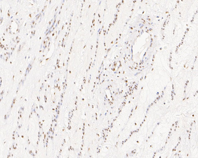 SUPT5H Antibody in Immunohistochemistry (Paraffin) (IHC (P))