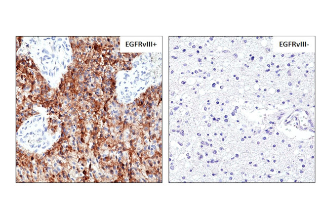 EGFRvIII Antibody in Immunohistochemistry (Paraffin) (IHC (P))
