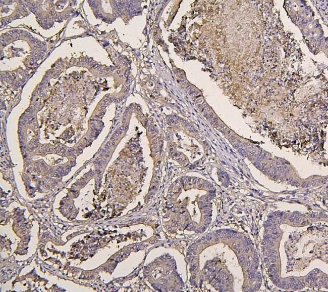 IRS1 Antibody in Immunohistochemistry (Paraffin) (IHC (P))