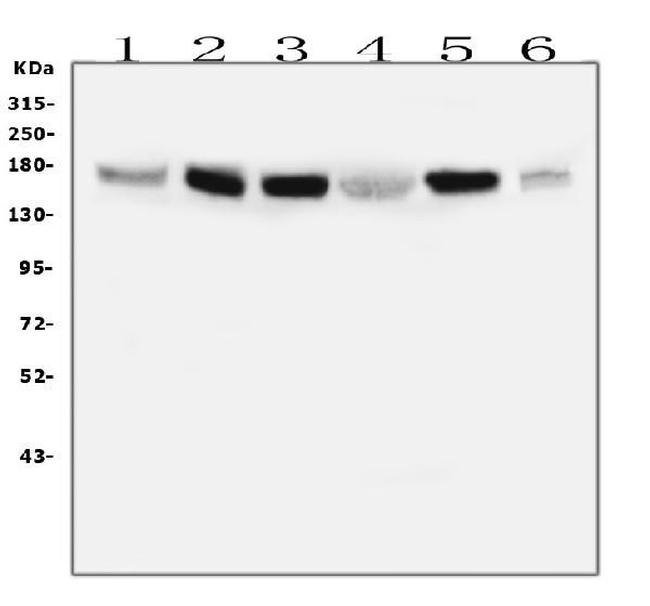 IRS1 Antibody in Western Blot (WB)