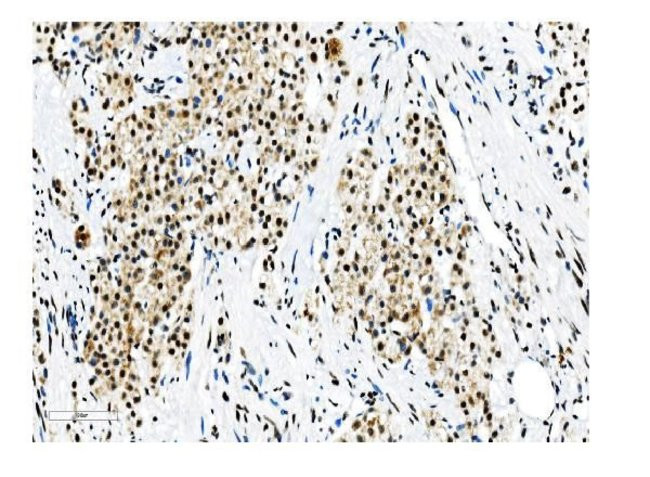 NRF1 Antibody in Immunohistochemistry (Paraffin) (IHC (P))