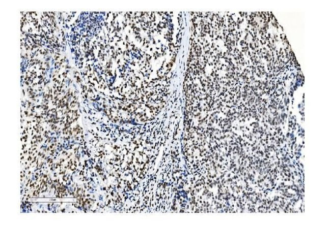 NRF1 Antibody in Immunohistochemistry (Paraffin) (IHC (P))