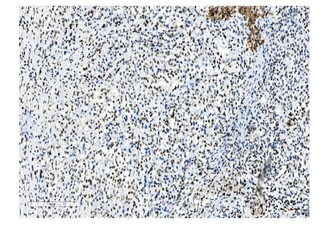 NRF1 Antibody in Immunohistochemistry (Paraffin) (IHC (P))