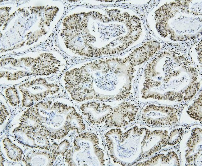 NRF1 Antibody in Immunohistochemistry (Paraffin) (IHC (P))