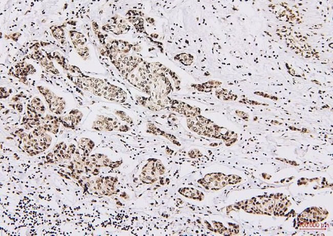 NRF1 Antibody in Immunohistochemistry (Paraffin) (IHC (P))