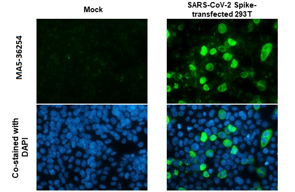 SARS-CoV-2 Spike Protein S2 Antibody in Immunocytochemistry (ICC/IF)