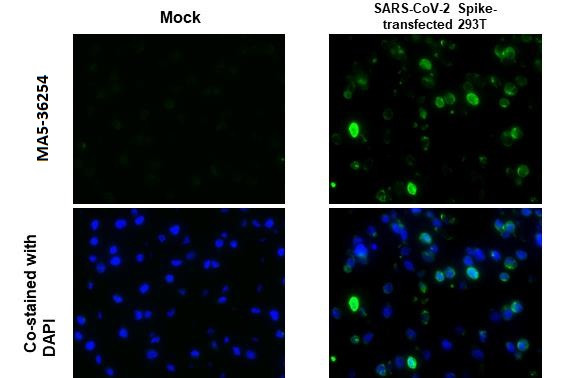 SARS-CoV-2 Spike Protein S2 Antibody in Immunocytochemistry (ICC/IF)