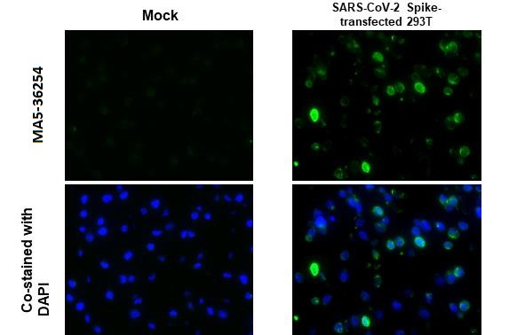 Sars Cov 2 Spike Protein S2 Recombinant Monoclonal Antibody Hl237 Ma5 36254