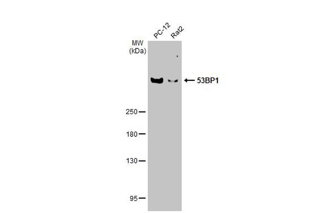 53BP1 Antibody in Western Blot (WB)