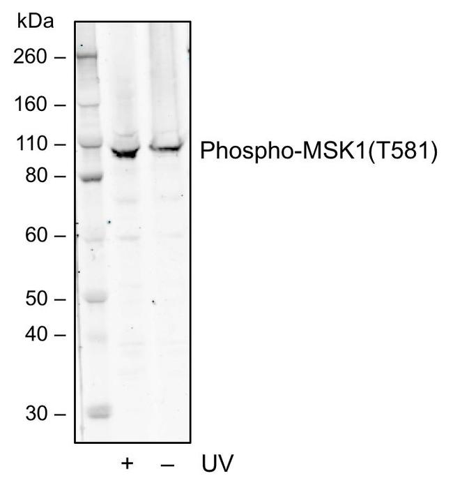 Phospho-MSK1 (Thr581) Antibody in Western Blot (WB)