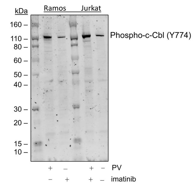 Phospho-c-Cbl (Tyr774) Antibody in Western Blot (WB)