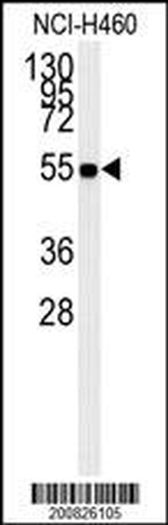 ALDH1A1 Antibody in Western Blot (WB)