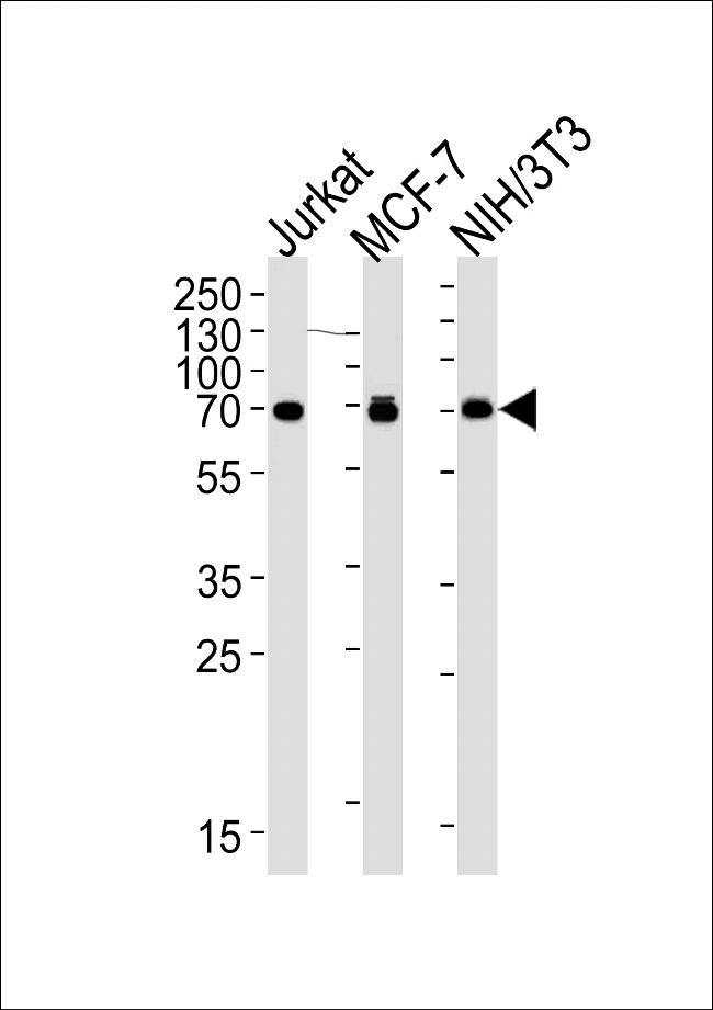 RPS6KB2 Antibody in Western Blot (WB)