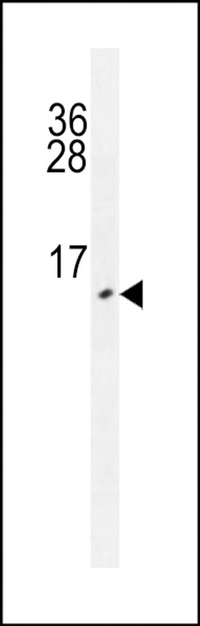 URM1 Antibody in Western Blot (WB)
