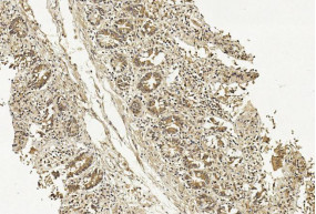 METAP1 Antibody in Immunohistochemistry (Paraffin) (IHC (P))