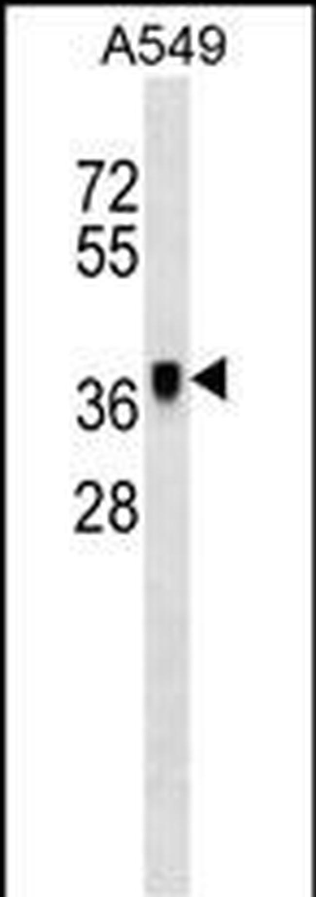 METAP1 Antibody in Western Blot (WB)