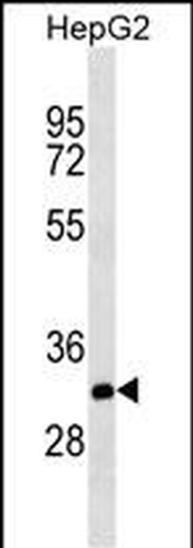 THAP11 Antibody in Western Blot (WB)