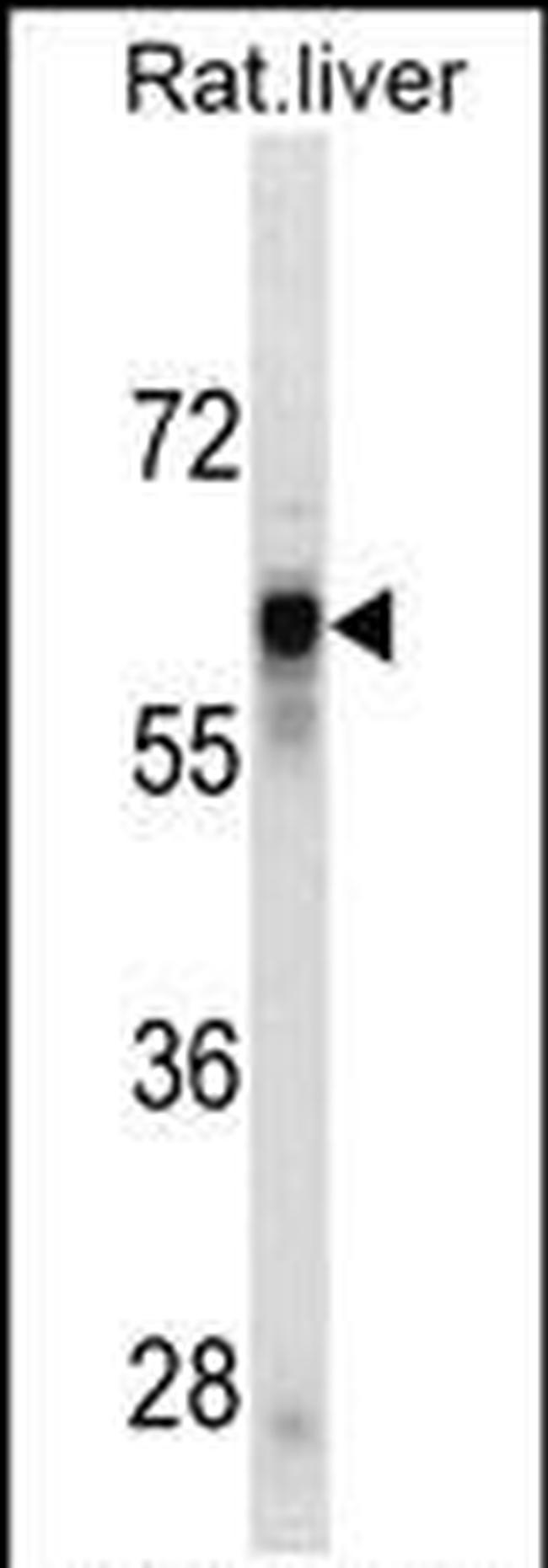 SERPINC1 Antibody in Western Blot (WB)