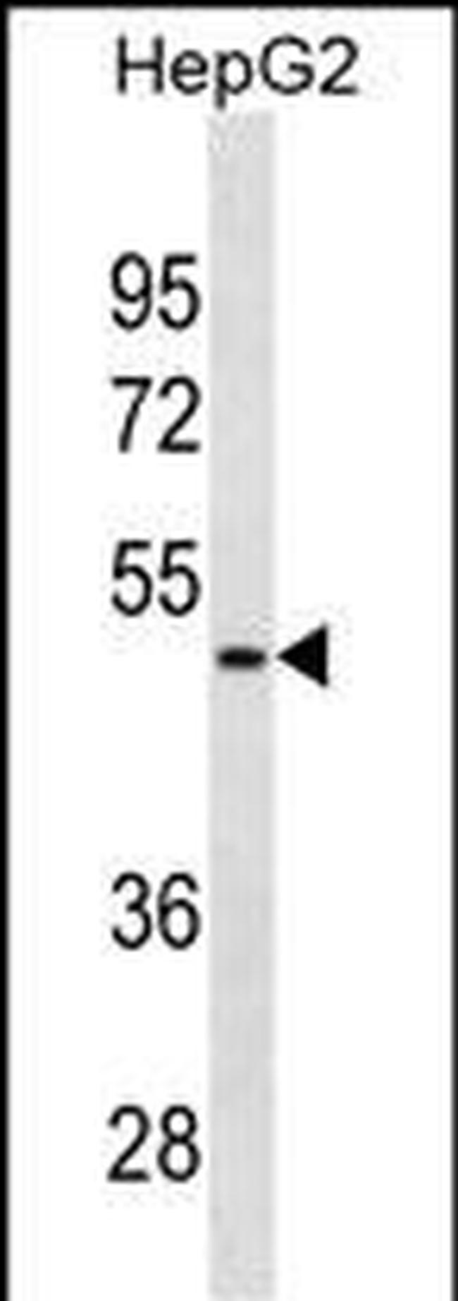 alpha-1 Microglobulin Antibody in Western Blot (WB)