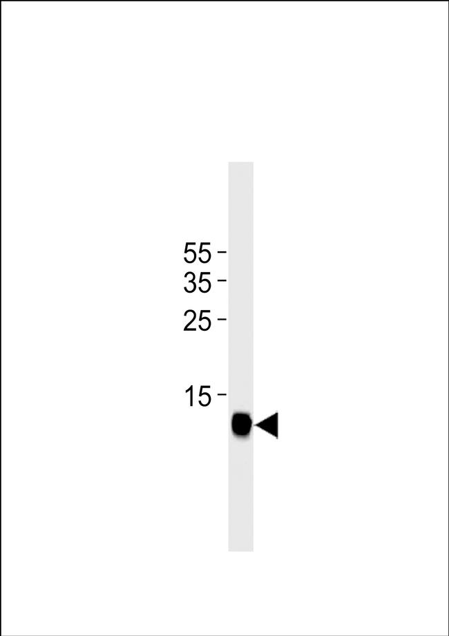 FABP3 Antibody in Western Blot (WB)