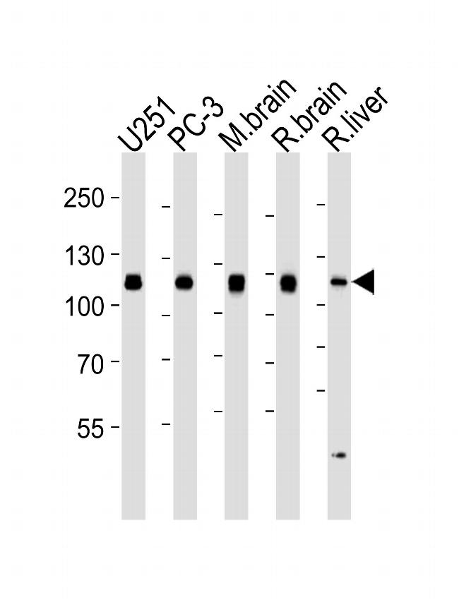 USP5 Antibody in Western Blot (WB)