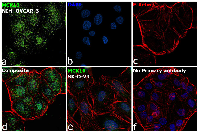 MCK10 Antibody in Immunocytochemistry (ICC/IF)