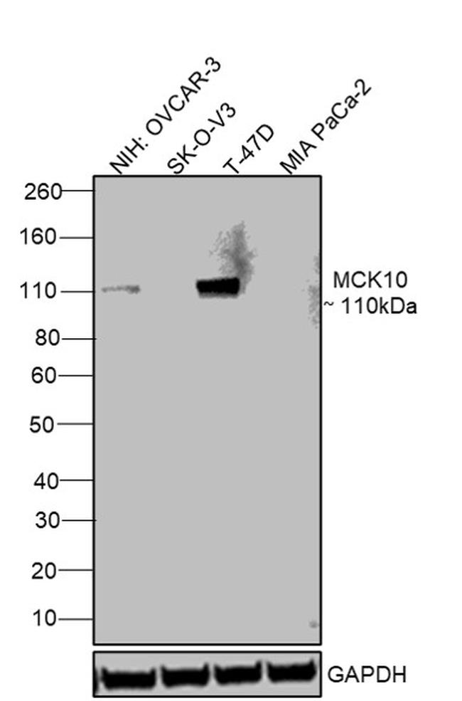 MCK10 Antibody in Western Blot (WB)