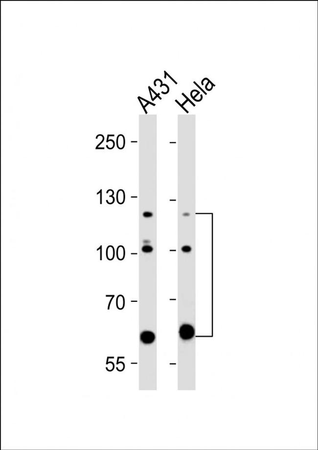 Abl2 Antibody in Western Blot (WB)