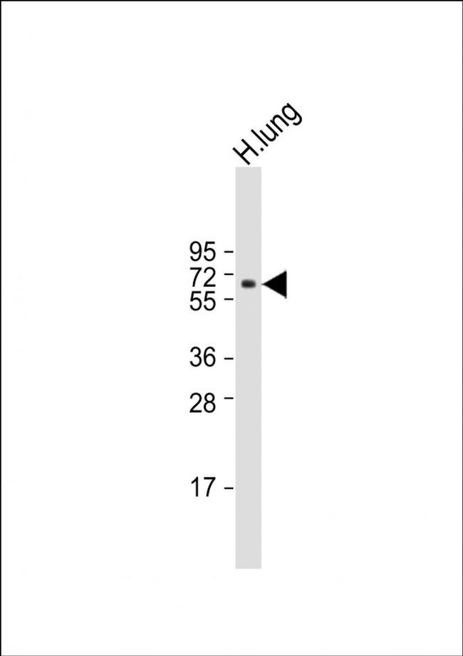 RYK Antibody in Western Blot (WB)