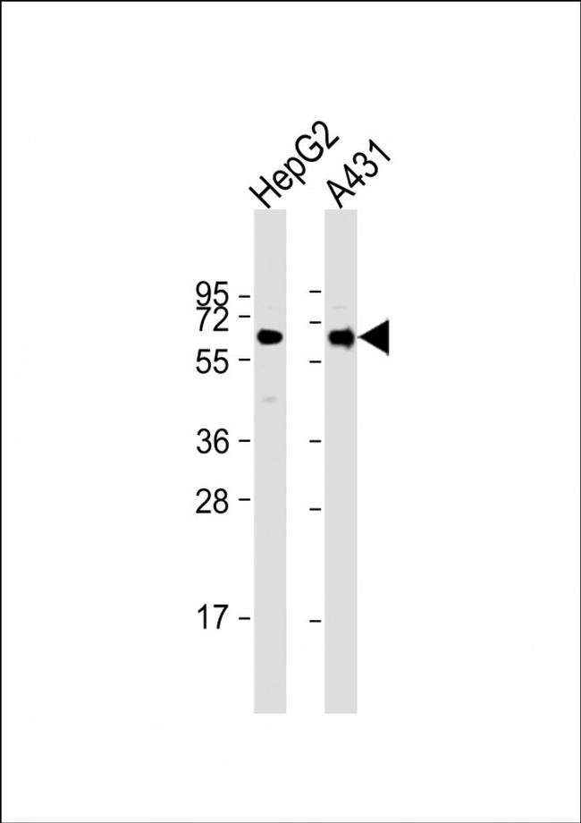 RAP1 Antibody in Western Blot (WB)