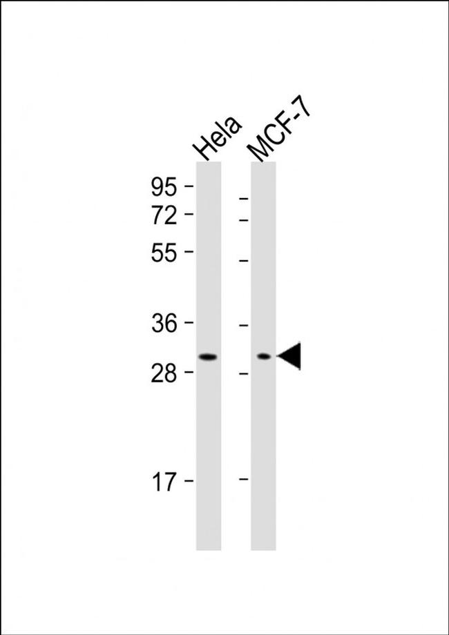 RAB20 Antibody in Western Blot (WB)