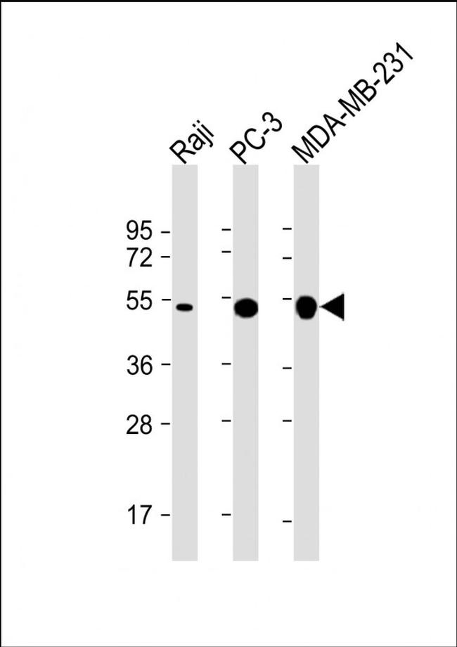 MMP1 Antibody in Western Blot (WB)