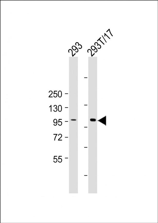 HACE1 Antibody in Western Blot (WB)