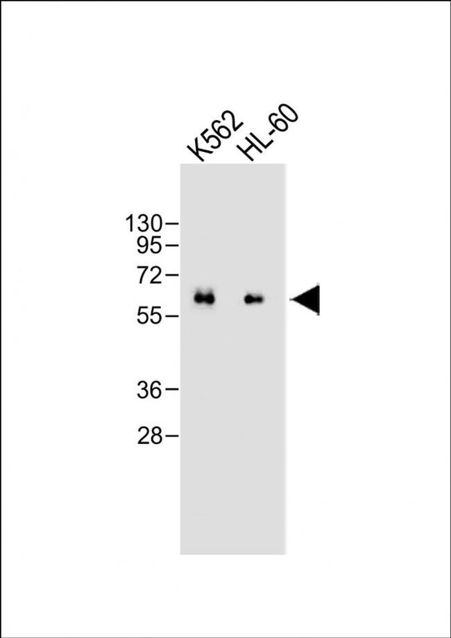 CARD9 Antibody in Western Blot (WB)