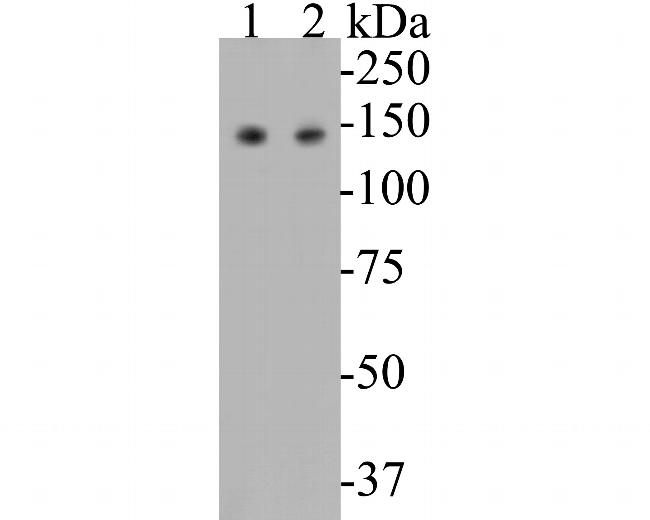 USP28 Antibody in Western Blot (WB)