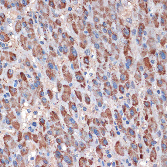 TIMM50 Antibody in Immunohistochemistry (Paraffin) (IHC (P))