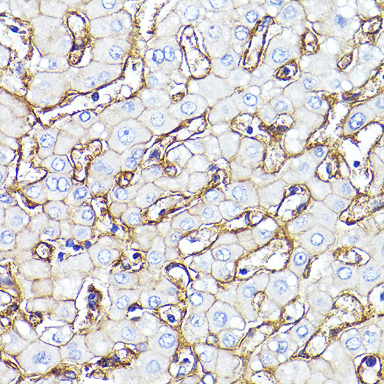 CD29 (Integrin beta 1) Antibody in Immunohistochemistry (Paraffin) (IHC (P))