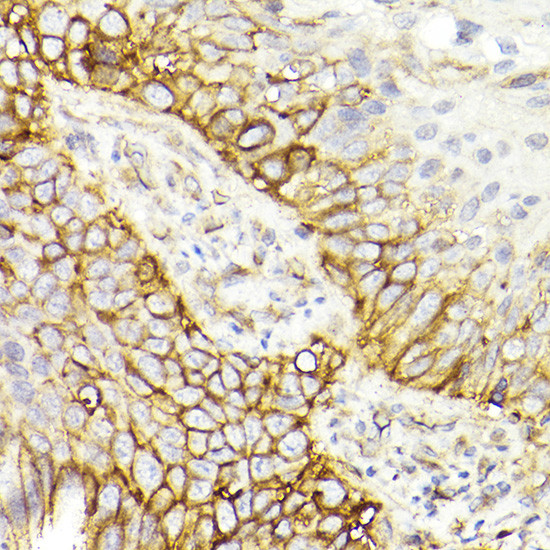 CD29 (Integrin beta 1) Antibody in Immunohistochemistry (Paraffin) (IHC (P))