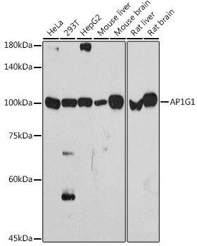 gamma Adaptin Recombinant Monoclonal Antibody (ARC2440) (MA5-37896)