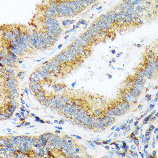 alpha COP Antibody in Immunohistochemistry (Paraffin) (IHC (P))