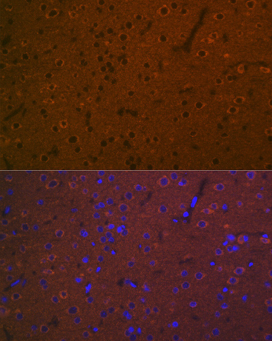 HTR7 Antibody in Immunohistochemistry (Paraffin) (IHC (P))