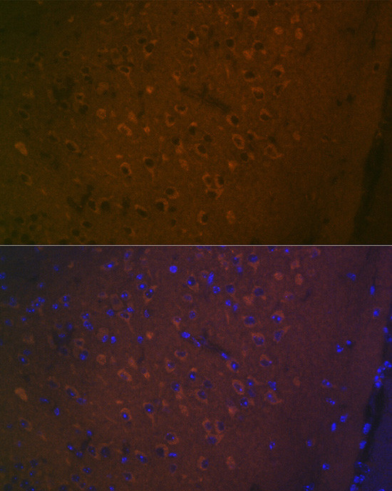 HTR7 Antibody in Immunohistochemistry (Paraffin) (IHC (P))