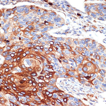 ORM1 Antibody in Immunohistochemistry (Paraffin) (IHC (P))